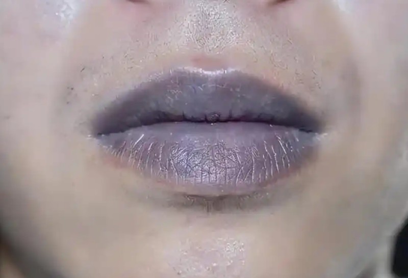  别再盯着嘴唇了：脑梗预防的逆向思维与真相 健康养生